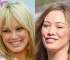 Hilary Duff, la ex chica Disney cambió su dulce sonrisa por recurrentes inyecciones de Botox.